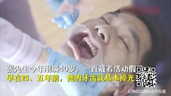 太可怕了！杭州一男子患牙周炎又常熬夜掉光了一口牙