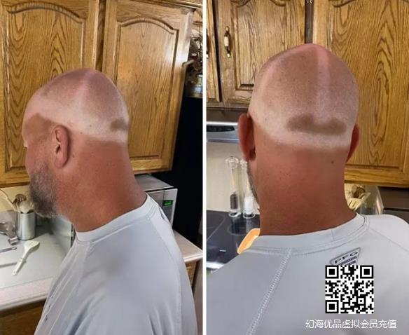 网友分享「不涂防晒的结果」照片：感受火辣阳光吧！